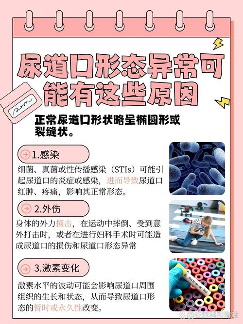 女性下边有黄色分泌物的相关介绍