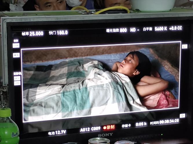 30岁的女人脸色暗黄无光泽的相关介绍