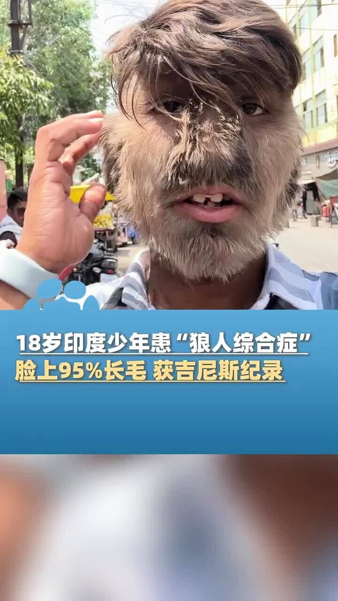 18末年禁止免费观看的相关介绍